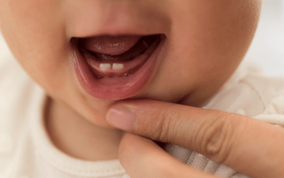 Die ersten Zähne: Voller Durchbruch