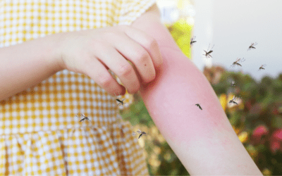 Insektenstiche bei Kindern: Nicht immer vermeidbar